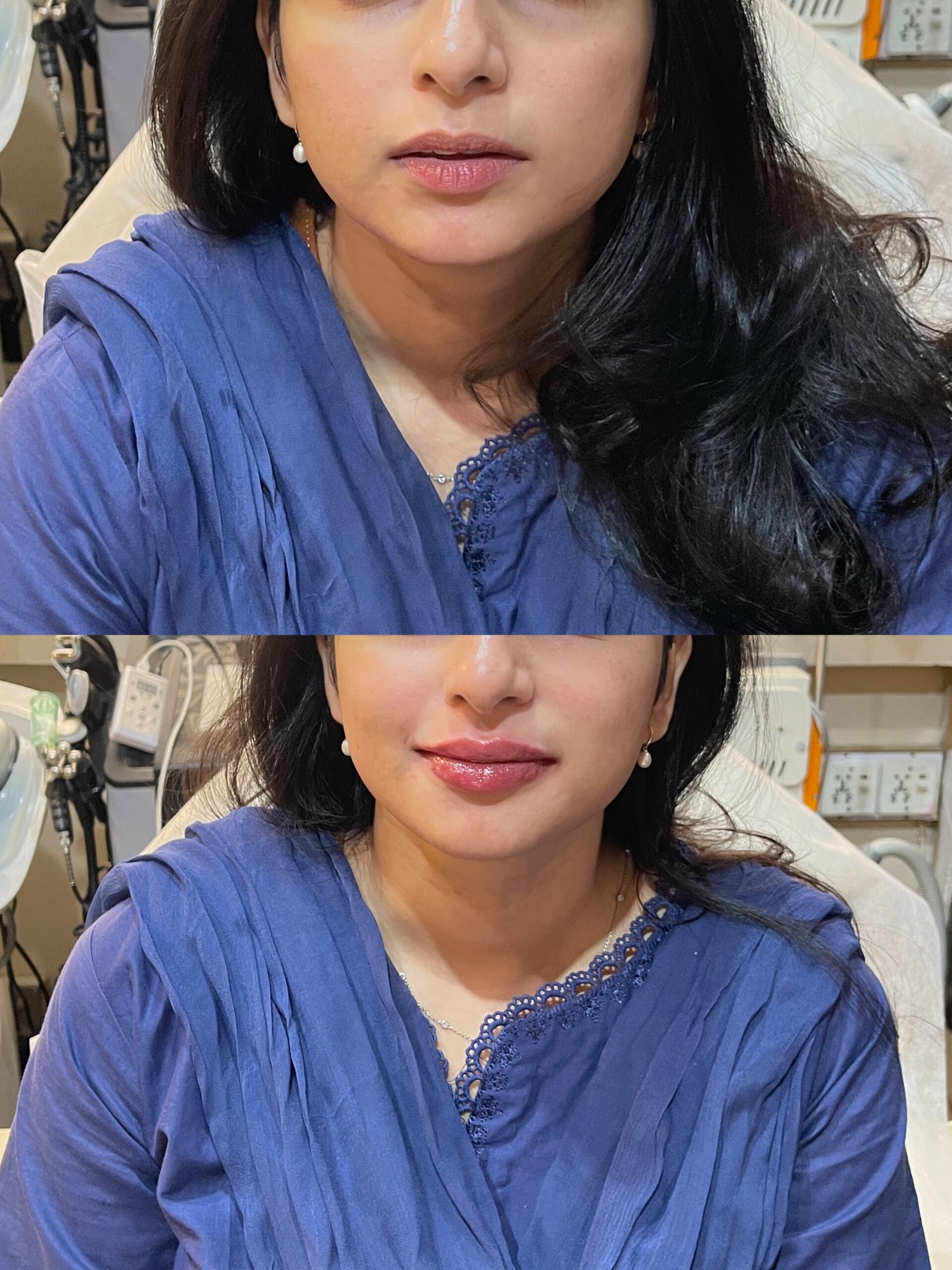 ISIMG-946924