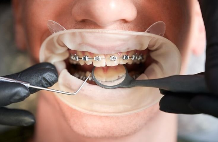 Best Orthodontist in DHA, Karachi