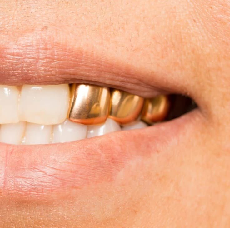 Gold Piece