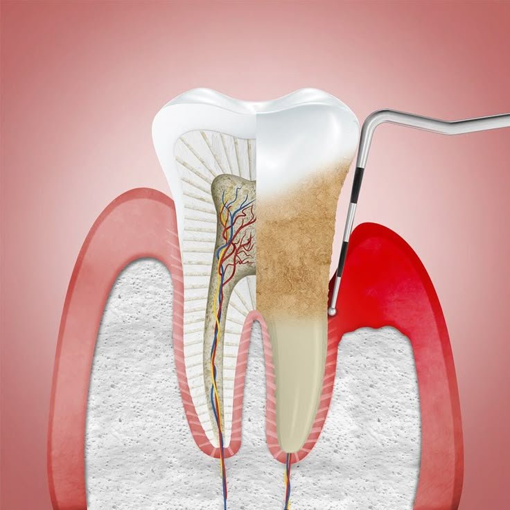 Periodontist in DHA Karachi