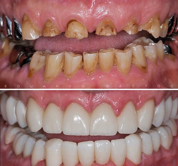 Restorative Dental Treatment