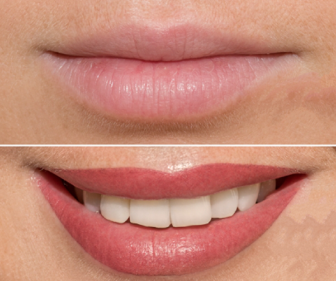 lips-tint