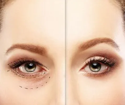 liquid-face-lift3